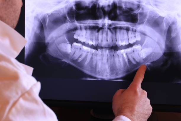 Best Cracked Tooth Emergency Dentist  in South Lebanon, OH