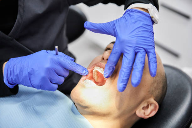 Best Knocked-Out Tooth Emergency  in South Lebanon, OH