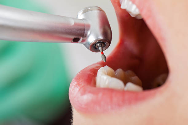 Best Dentist for Tooth Abscess  in South Lebanon, OH